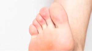 Foot Treatments & Surgery - Shoreline Foot and Ankle | Muskegon ...